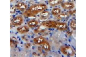 Used in DAB staining on fromalin fixed paraffin-embedded Kidney tissue (PDGF-AA Homodimer (AA 87-211) Antikörper)