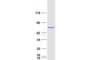 Western Blotting (WB) image for NOP2/Sun Domain Family, Member 6 (NSUN6) protein (Myc-DYKDDDDK Tag) (ABIN2727655)