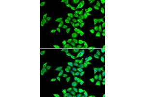 Immunofluorescence analysis of U2OS cells using NMT2 antibody (ABIN5974237). (NMT2 Antikörper)