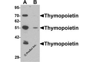 Western Blotting (WB) image for anti-Thymopoietin (TMPO) (N-Term) antibody (ABIN1031615)