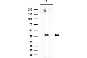 anti-Rh Family A Glycoprotein (RHAG) antibody