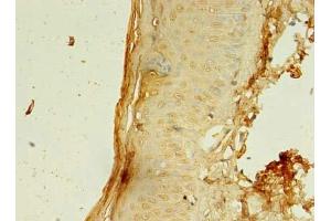 Immunohistochemistry of paraffin-embedded human skin tissue using ABIN7148112 at dilution of 1:100 (CCDC24 Antikörper  (AA 1-307))