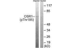 Western blot analysis of extracts from HepG2 cells treated with serum using OSR1 (Phospho-Thr185) Antibody. (OXSR1 Antikörper  (pThr185))