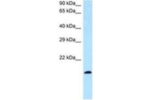 Image no. 1 for anti-Bone Marrow Stromal Cell Antigen 2 (BST2) (N-Term) antibody (ABIN6747353) (BST2 Antikörper  (N-Term))
