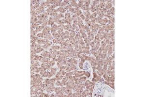 Immunohistochemical analysis of A on paraffin-embedded Human liver tissue.