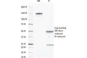SDS-PAGE Analysis Purified CD40 Mouse Monoclonal Antibody (C40/2383). (CD40 Antikörper  (AA 29-107))