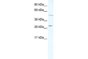 WB Suggested Anti-CASP3 Antibody Titration:  5ug/ml  Positive Control:  Human Liver (Caspase 3 Antikörper  (N-Term))