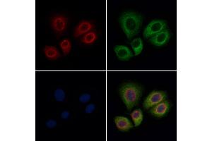 ABIN6262848 and ABIN6276891 staining Hela cells by IF/ICC. (Kallikrein 1 Antikörper  (Internal Region))
