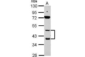 WB Image Sample (30 ug of whole cell lysate) A: HepG2 10% SDS PAGE antibody diluted at 1:1000 (Retinoic Acid Receptor beta Antikörper)