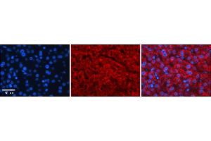 Rabbit Anti-GAMT Antibody    Formalin Fixed Paraffin Embedded Tissue: Human Adult liver  Observed Staining: Cytoplasmic Primary Antibody Concentration: 1:100 Secondary Antibody: Donkey anti-Rabbit-Cy2/3 Secondary Antibody Concentration: 1:200 Magnification: 20X Exposure Time: 0.
