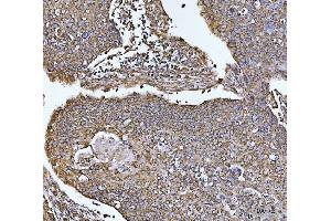 IHC analysis of COX5B using anti-COX5B antibody (ABIN7598975). (COX5B Antikörper  (AA 1-129))