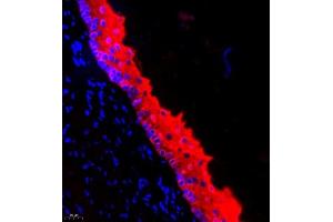 Immunofluorescence of paraffin embedded rat esophagus using CK13 (ABIN7074411) at dilution of 1:500 (400x lens) (Cytokeratin 13 Antikörper  (C-Term))