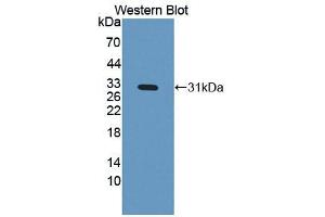 Western blot analysis of the recombinant protein. (IGFBP4 Antikörper  (AA 22-258))
