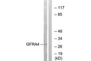 Western blot analysis of extracts from HeLa cells, using GFRA4 Antibody.