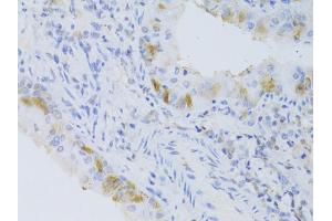 Immunohistochemistry of paraffin-embedded mouse lung using CYP2C9 Antibody (ABIN5973660) at dilution of 1/100 (40x lens). (CYP2C9 Antikörper)