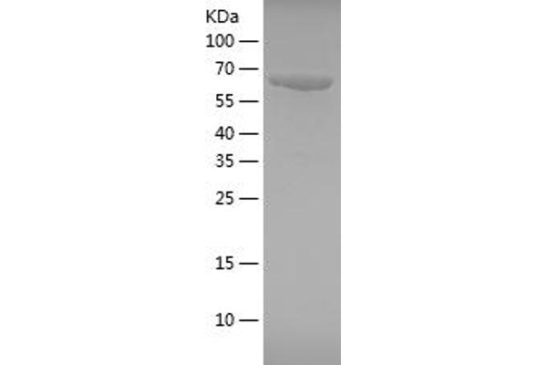 HSP70 1A Protein (AA 291-641) (His-IF2DI Tag)