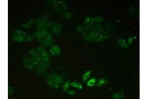 Detection of MCM2 in Human Hela Cells using Polyclonal Antibody to Minichromosome Maintenance Deficient 2 (MCM2) (Minichromosome Maintenance Deficient 2 (AA 473-679) Antikörper)