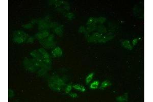 Detection of MCM2 in Human Hela Cells using Polyclonal Antibody to Minichromosome Maintenance Deficient 2 (MCM2) (MCM2 Antikörper  (AA 473-679))