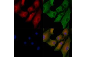 ABIN6263697 and ABIN6278402 staining  cells by IF/ICC.