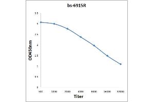 Antigen: 0. (AUTS2 Antikörper  (AA 845-945))