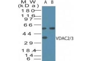 Image no. 1 for anti-Voltage-Dependent Anion Channel 2/3 (VDAC2/3) (AA 120-132) antibody (ABIN960406) (VDAC2/3 Antikörper  (AA 120-132))