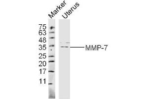 Mouse Uterus lysates probed with MMP-7 Polyclonal Antibody, unconjugated  at 1:300 overnight at 4°C followed by a conjugated secondary antibody at 1:10000 for 60 minutes at 37°C. (MMP7 Antikörper  (AA 151-250))