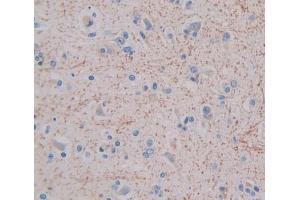 IHC-P analysis of brain tissue, with DAB staining. (GHRHR Antikörper  (AA 23-130))