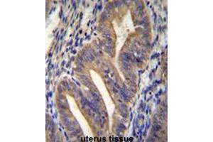 METTL10 Antibody (N-term) immunohistochemistry analysis in formalin fixed and paraffin embedded human uterus tissue followed by peroxidase conjugation of the secondary antibody and DAB staining.