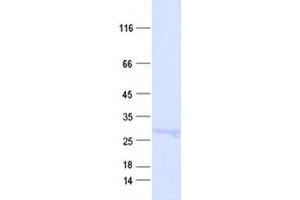 Western Blotting (WB) image for Regulator of Calcineurin 1 (RCAN1) protein (His tag) (ABIN2713039)