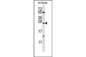 Western blot analysis using SFTPC Antibody (N-term) Cat.