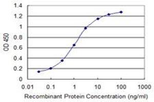 Detection limit for recombinant GST tagged MACF1 is 0. (MACF1 Antikörper  (AA 1-95))