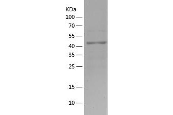 KAT2B Protein (AA 636-832) (His-IF2DI Tag)