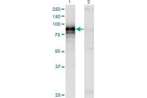 Western Blotting (WB) image for anti-Hedgehog Interacting Protein (HHIP) (AA 21-121) antibody (ABIN466235) (HHIP Antikörper  (AA 21-121))