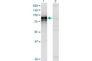 Western Blotting (WB) image for anti-Hedgehog Interacting Protein (HHIP) (AA 21-121) antibody (ABIN466235)