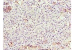Immunohistochemistry of paraffin-embedded human pancreatic tissue using ABIN7151902 at dilution of 1:100 (EPS15L1 Antikörper  (AA 585-864))