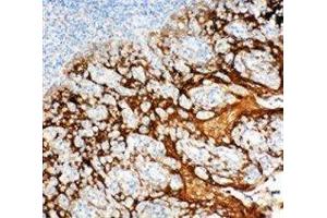 Anti-14-3-3 sigma antibody, IHC(P) IHC(P): Human Tonsil Tissue
