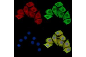 anti-Neurexin 2 (NRXN2) antibody