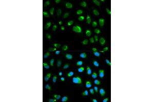 Immunofluorescence analysis of HeLa cell using TLR1 antibody. (TLR1 Antikörper  (AA 30-290))