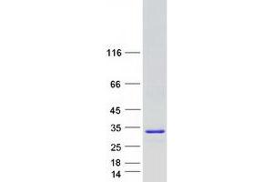 Validation with Western Blot