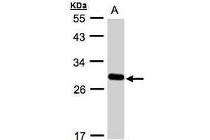 WB Image Sample(30 ug whole cell lysate) A:A431, 12% SDS PAGE antibody diluted at 1:1000
