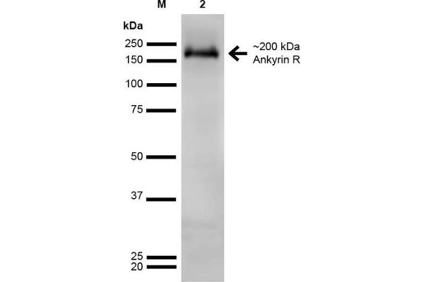 Erythrocyte Ankyrin antibody  (AA 1-1881) (HRP)
