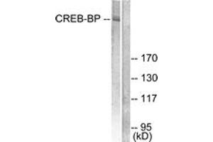 Western blot analysis of extracts from HeLa cells, treated with Insulin 0. (CBP Antikörper  (AA 2393-2442))