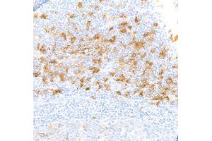 Immunohistochemistry (IHC) image for anti-Indoleamine 2,3-Dioxygenase 1 (IDO1) (AA 1-403) antibody (ABIN7449541) (Rekombinanter IDO1 Antikörper  (AA 1-403))