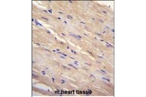 FB Antibody (N-term) (ABIN655226 and ABIN2844832) immunohistochemistry analysis in formalin fixed and paraffin embedded human m. (FAM69B Antikörper  (N-Term))