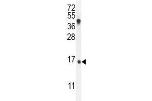 IGKV antibody western blot analysis in MDA-MB435 lysate. (IGKV A18 Antikörper  (AA 80-107))