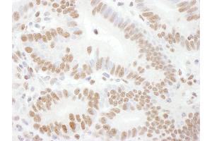 Immunohistochemistry (IHC) image for anti-RAD17 (RAD17) (pSer645) antibody (ABIN7449387)