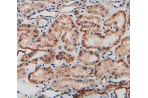 Used in DAB staining on fromalin fixed paraffin- embedded kidney tissue (KRT9 Antikörper  (AA 315-456))