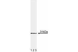 Western blot analysis of DsRed. (RFP Antikörper)