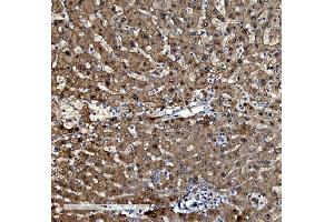 IHC analysis of PSMB5/MB1 using anti-PSMB5/MB1 antibody (ABIN7599183).