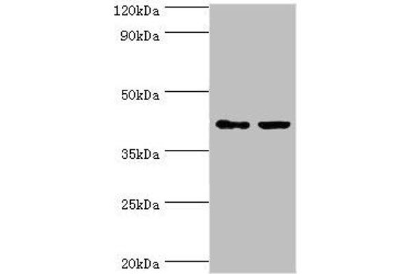 GTF2H2C Antikörper  (AA 1-260)